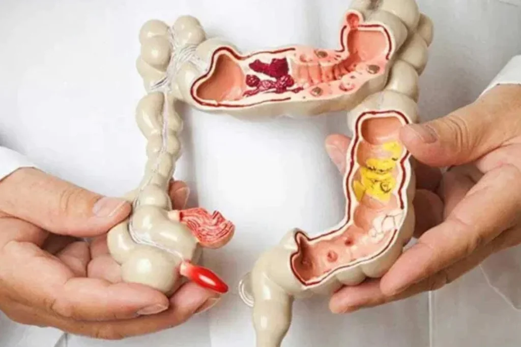 Telemedicina na Coloproctologia: Acessibilidade e Conveniência para Pacientes