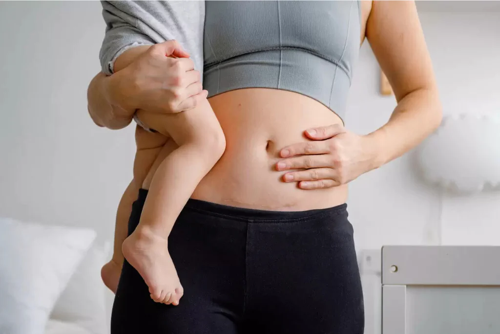 Incontinência Fecal Pós-Parto: O Que É e Como Tratar